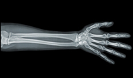 Feature Image 2